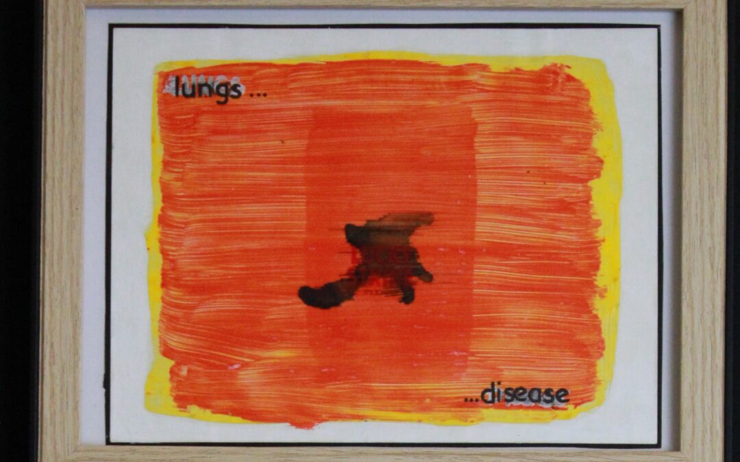 Lung diseases